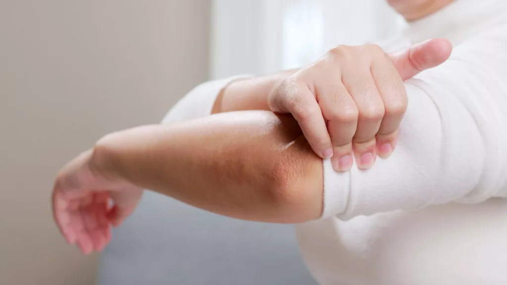 Young woman having pain in her elbow and using hand for self-massage to relieve aches and pains.